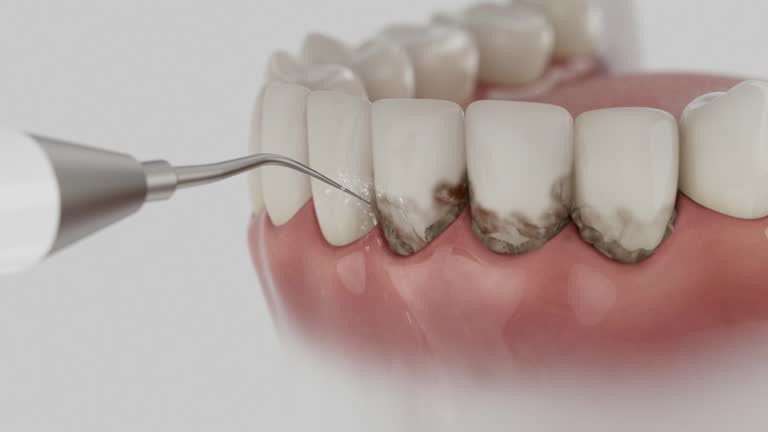 Trusted Tooth Extraction service in Daleville, IN - Dentist Open Now